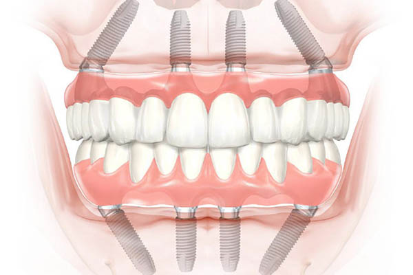 dental istanbul