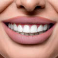 dental implant istanbul