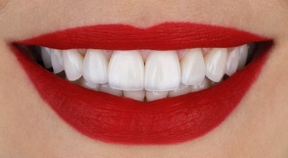 what-are-the-types-of-porcelain-dental-veneers-turkey