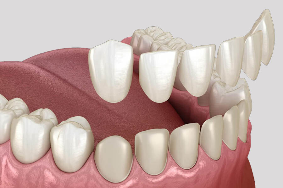 istanbul dental treatment