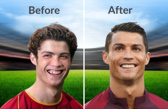 Ronaldo Teeth